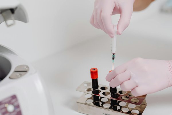 Huile de CBD : quelle est la meilleure option ?